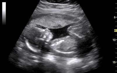 Ultrasound Images for Maternity Storylines  Back