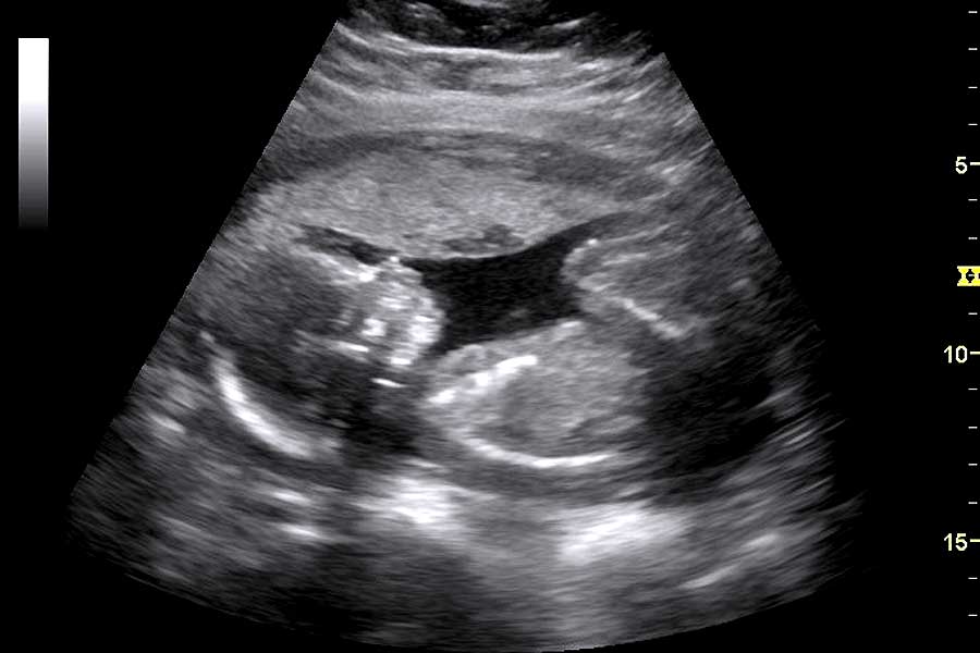 Ultrasound Images for Maternity Storylines  Back